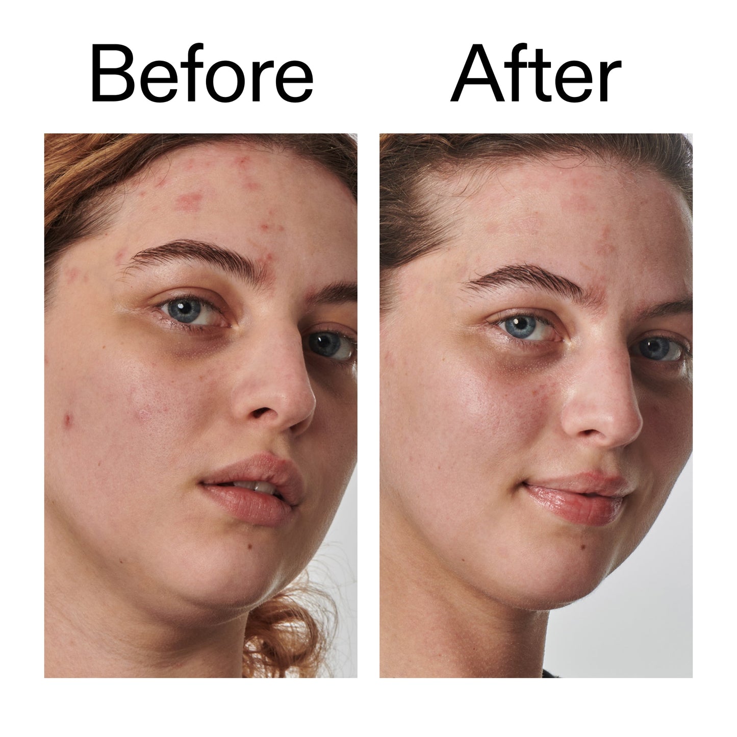 10-urea-moisturizer-e6 Dry_and_Rough_Skin_Solution_Before_After_2000x2000_efa6e639-5c39-49bd-a5dd-f0220293120a.jpg