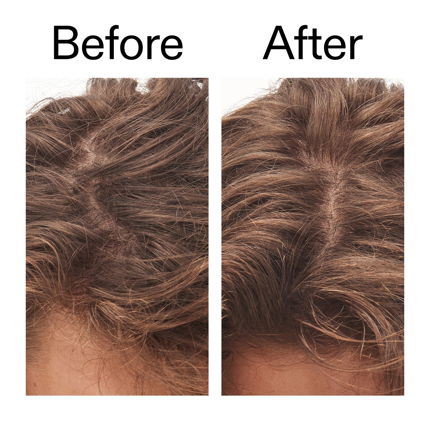 glycolic-acid-exfoliating-scalp-scrub-g9 Glycolic_Acid_Exfoliating_Scalp_Scrub_Before_After_2000x2000_b8561c87-05a1-4caa-80f7-1b6b33d750f7.jpg