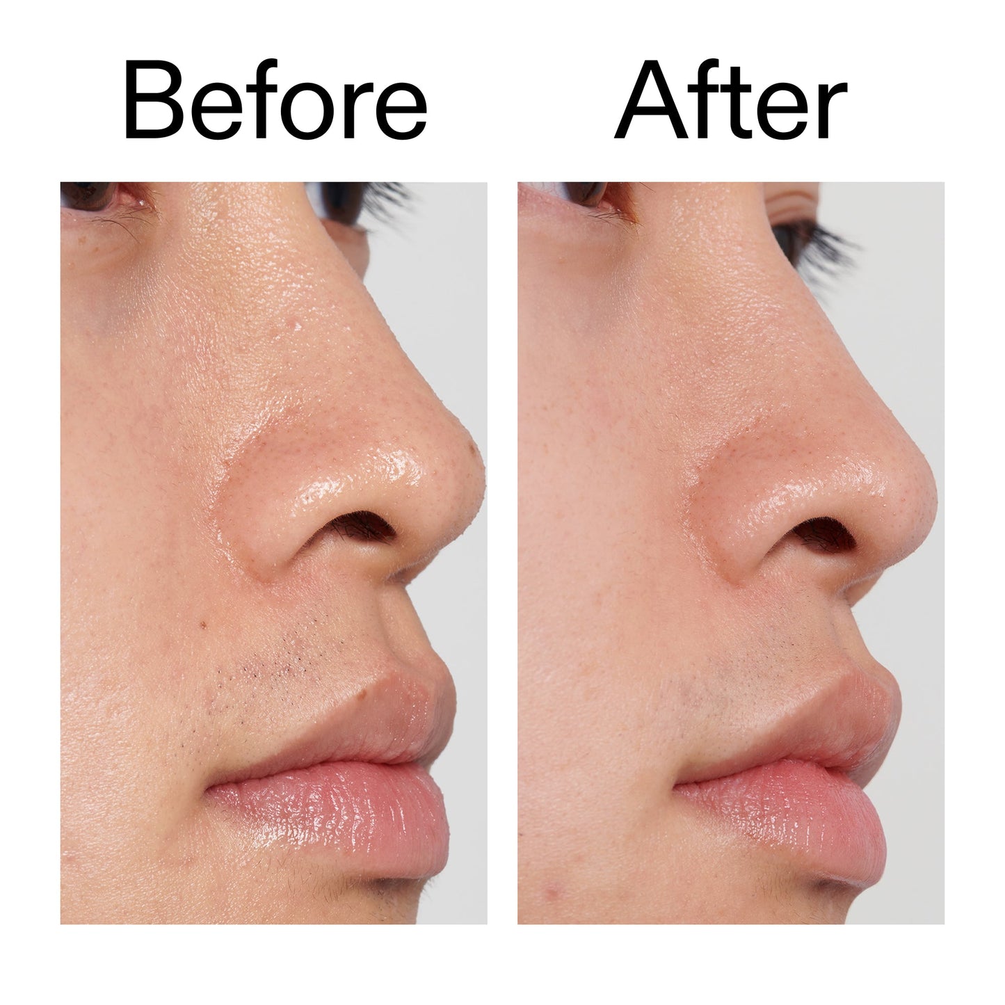 pha-toner-y1 PHA_Toner_Before_After_2000x2000_e3c10172-0150-4342-8b95-57417eaff50d.jpg