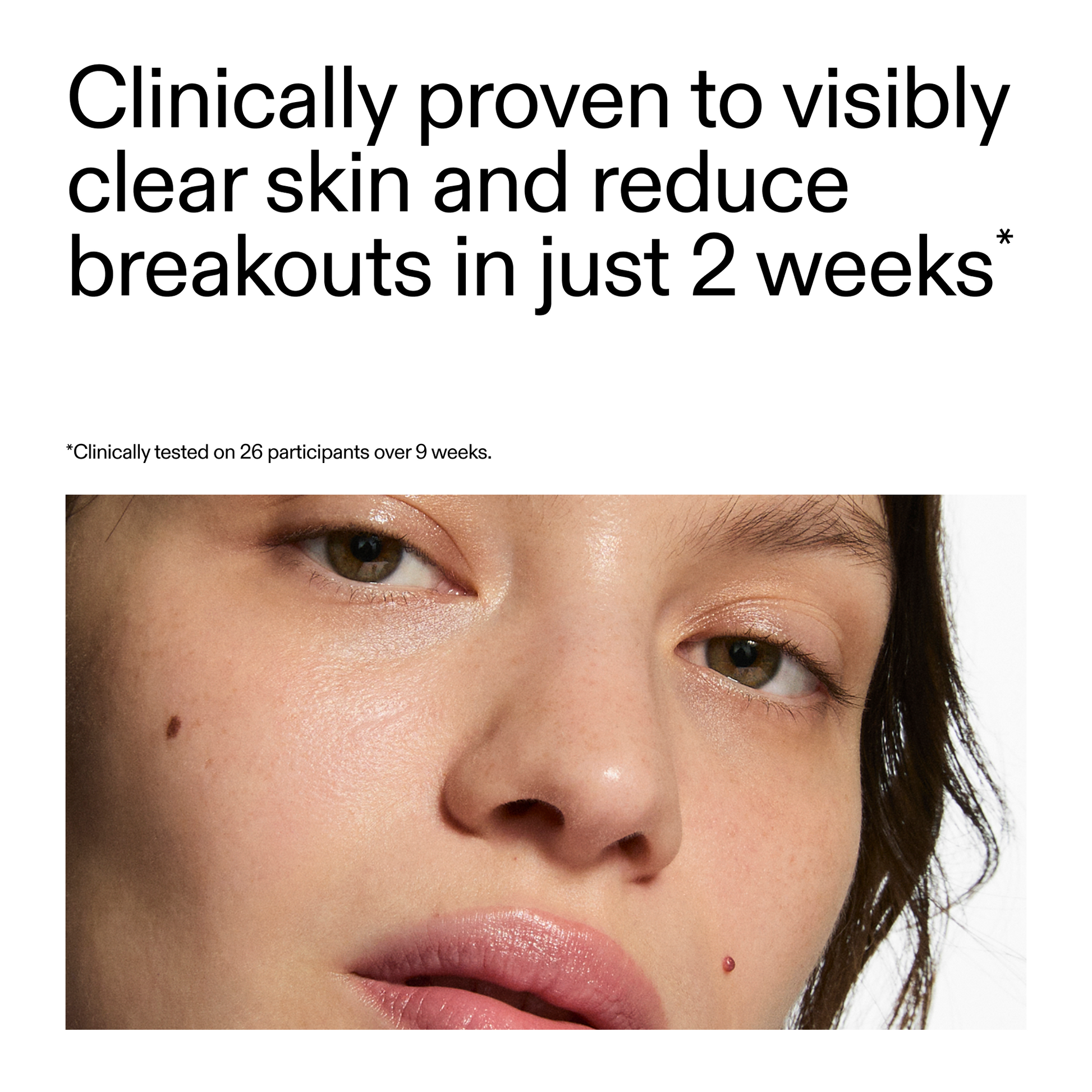360-acne-clearing-duo-g1 360_Serum_Key_Claim.png