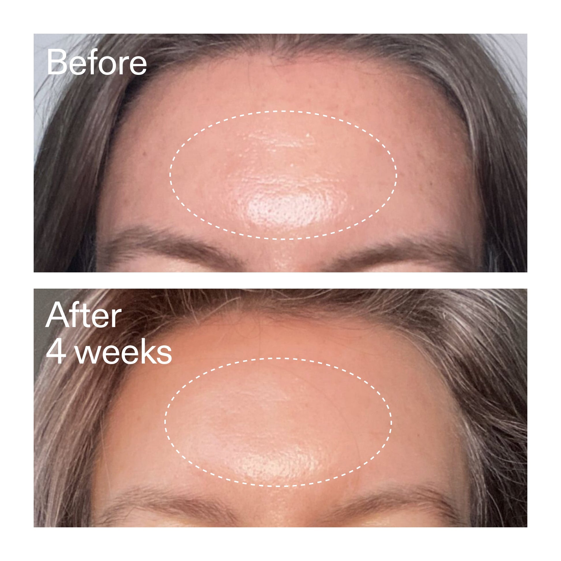 advanced-0-2-retinal-serum-duo-i0 AdvancedRetinal_BeforeAfter1_2000x2000_4e9c798a-f30e-45b8-a34a-7c4740f2f2cb.jpg