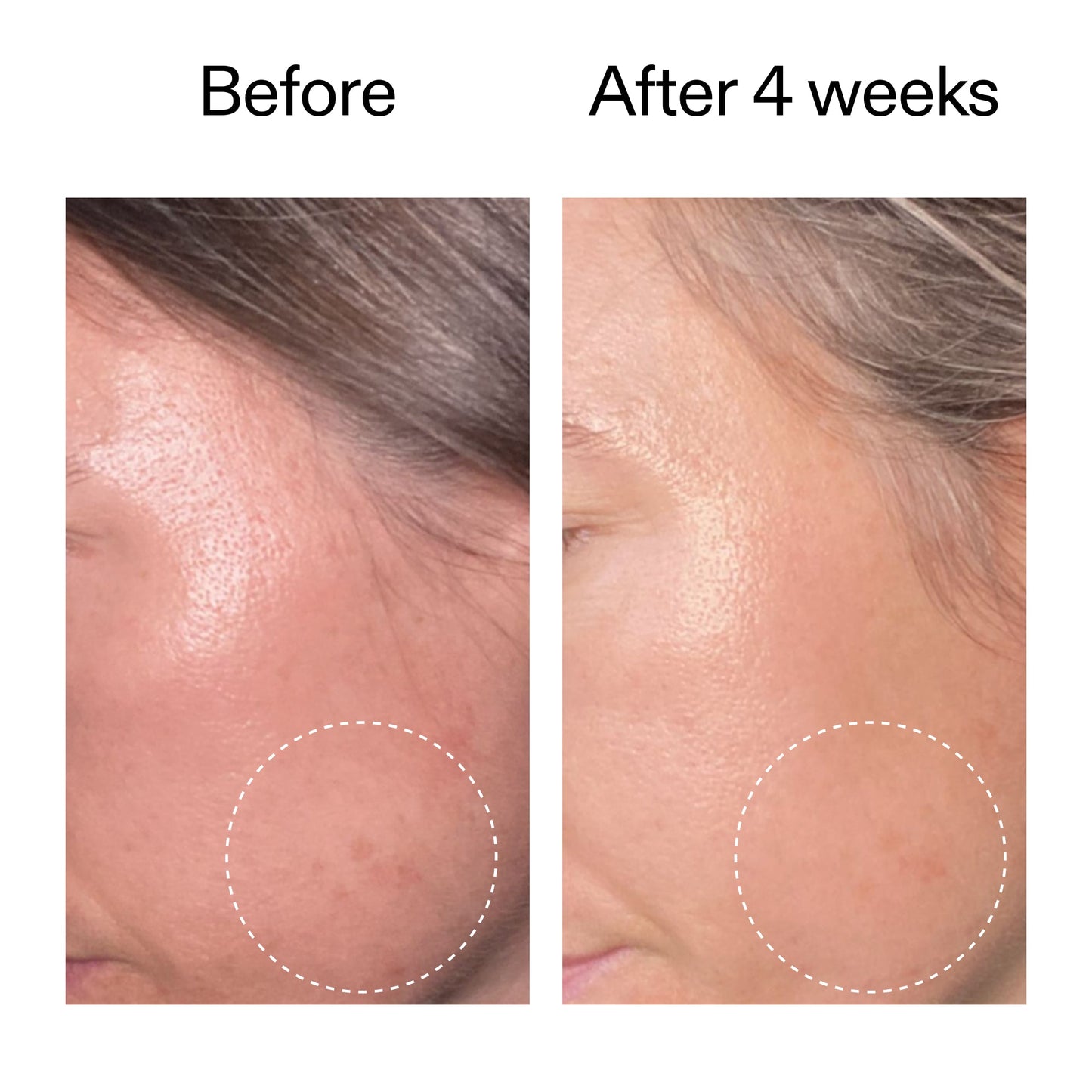 advanced-0-2-retinal-serum-e7 AdvancedRetinal_BeforeAfter2__2000x2000_62fb16bb-77ae-4d63-8500-88dbf847f4b9.jpg