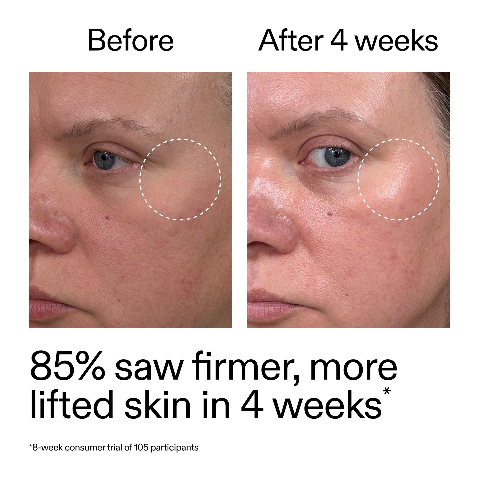 advanced-0-2-retinal-serum-e7 AdvancedRetinal_BeforeAfter_Claim1_2000x2000_bcc385c4-5e73-4f1e-aba8-64267937d0d3.jpg