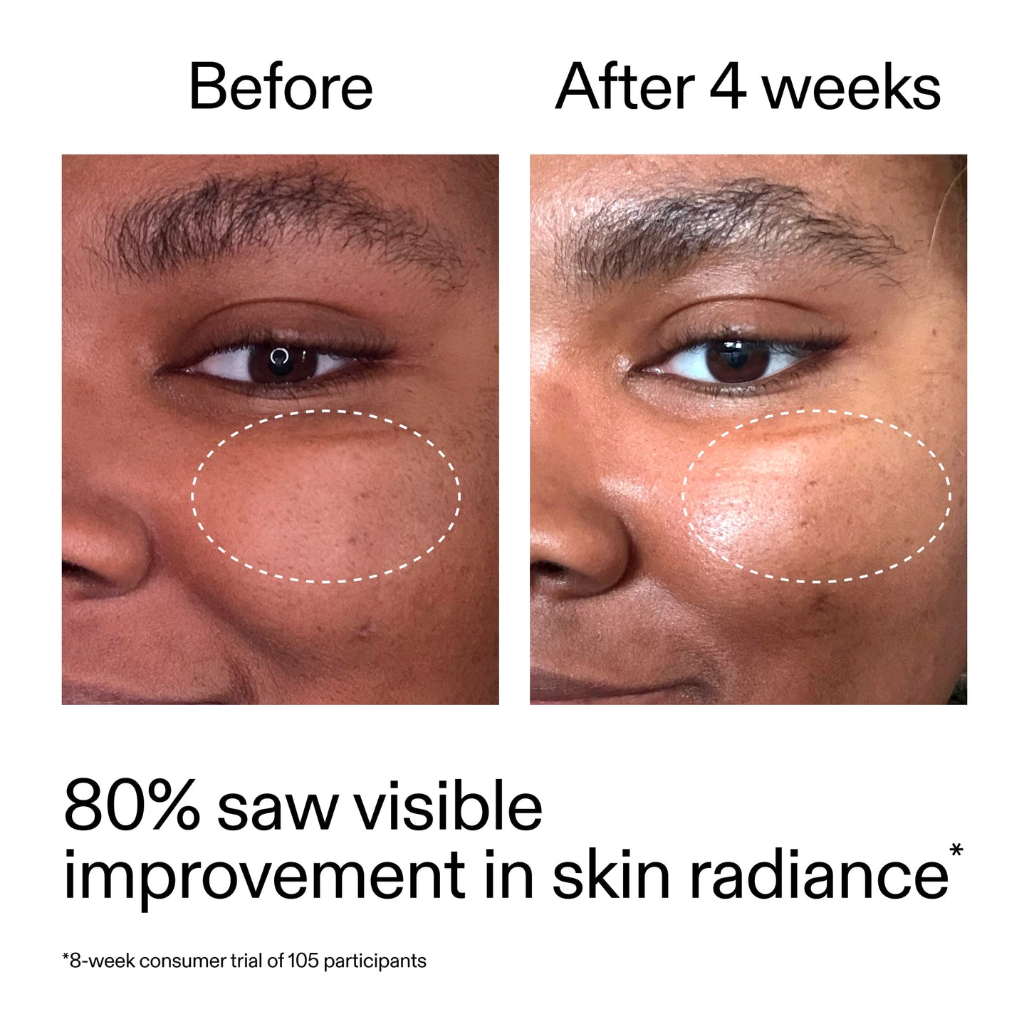 advanced-0-2-retinal-serum-e7 AdvancedRetinal_BeforeAfter_Claim2_2000x2000_39d11e3d-eda9-44ec-ab32-2903b1a368bd.jpg