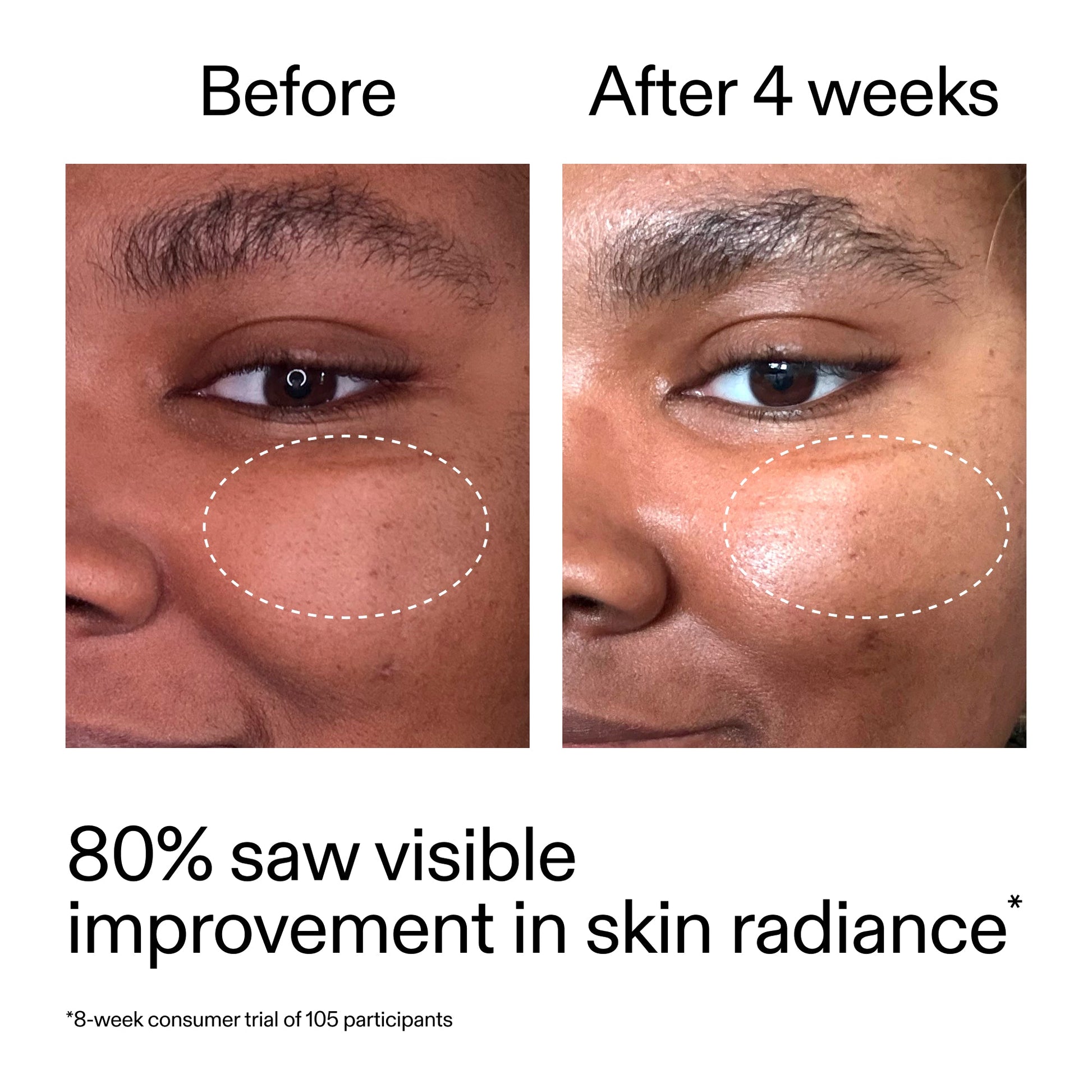 advanced-0-2-retinal-serum-e7 AdvancedRetinal_BeforeAfter_Claim2_2000x2000_39d11e3d-eda9-44ec-ab32-2903b1a368bd.jpg