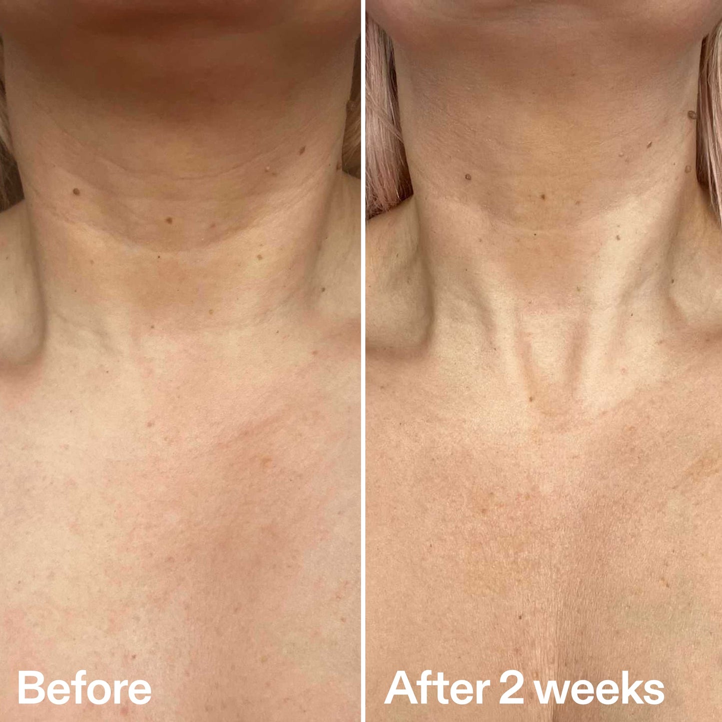 bio-active-neck-lift-stick-m9 B_A_2.jpg