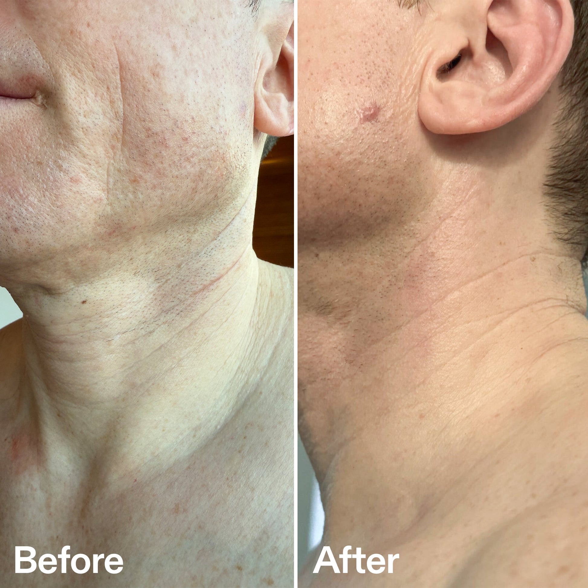 bio-active-neck-lift-stick-m9 B_A_afa2743e-b8e2-4504-92f4-e281cb6cf759.jpg