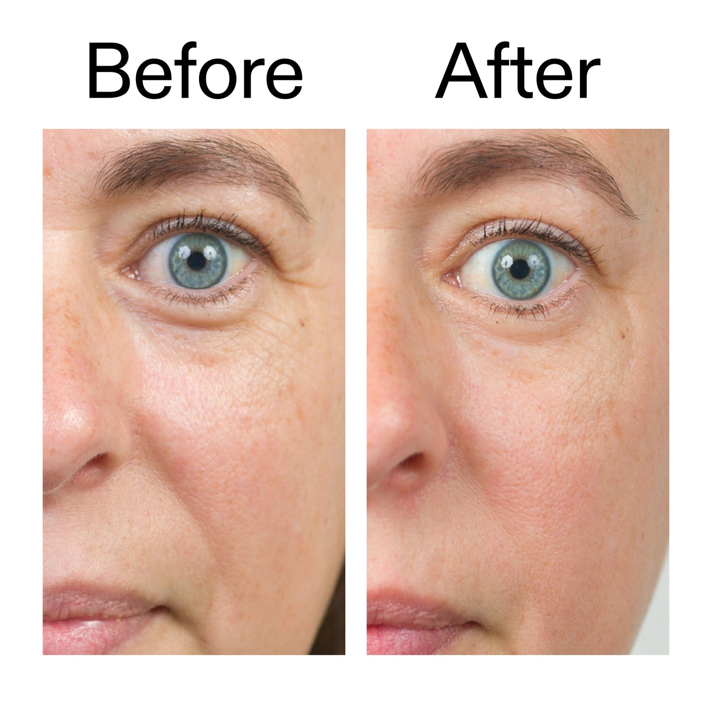 bio-active-ceramide-moisturizer-duo-v8 Bio-Active_Before_After_2000x2000_566e5a9e-135e-417a-8242-b44e5fa35463.jpg