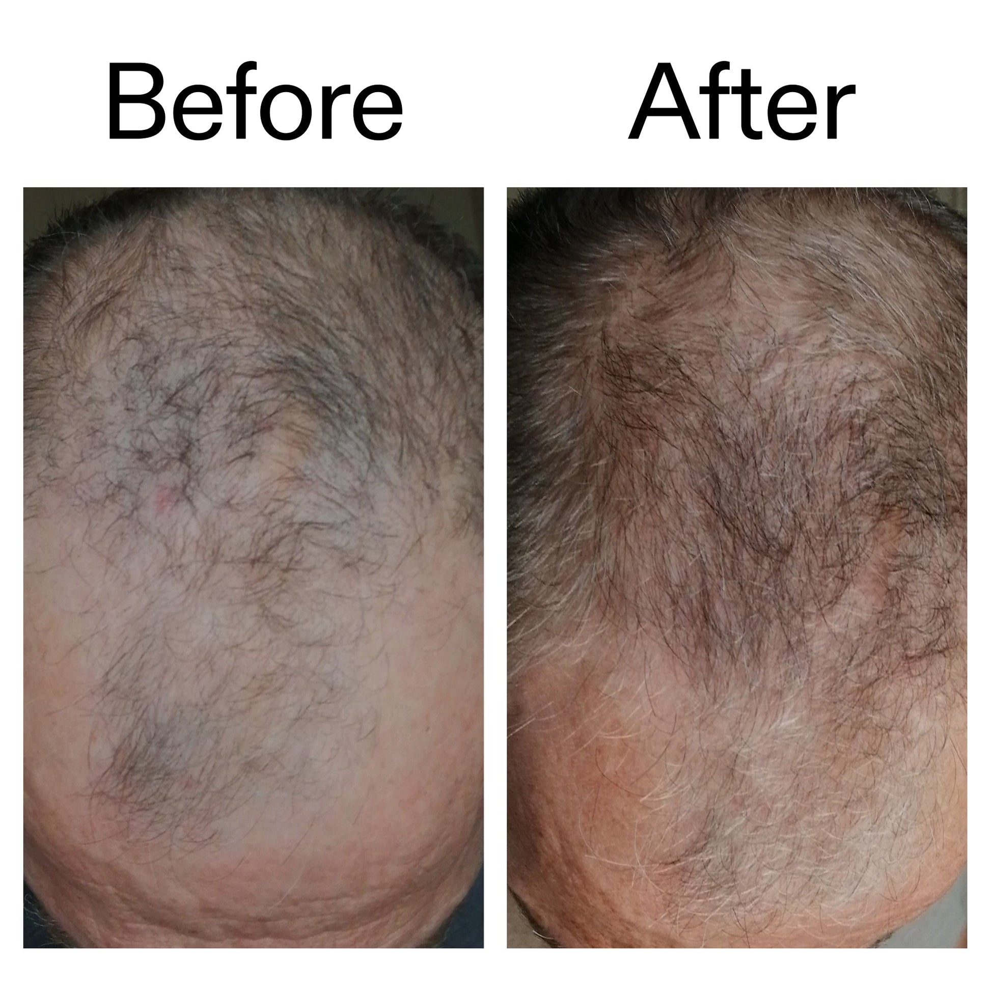 3-month-hair-growth-trio-c4 Caffeine_Scalp_Treatment_B_A_Ppage_2000_x_2000.jpg