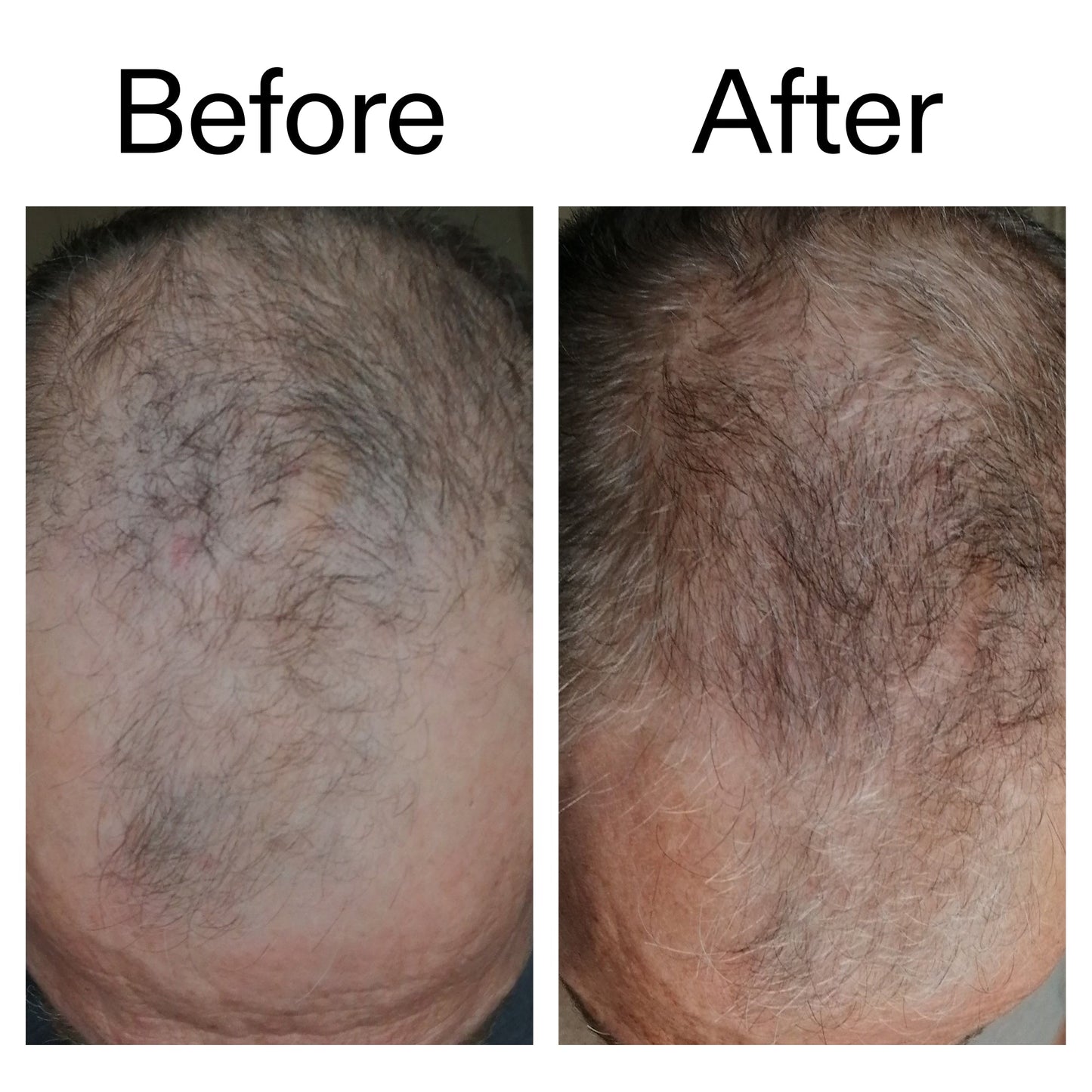 caffeine-stimulating-scalp-treatment-q7 Caffeine_Scalp_Treatment_B_A_Ppage_2000_x_2000.jpg