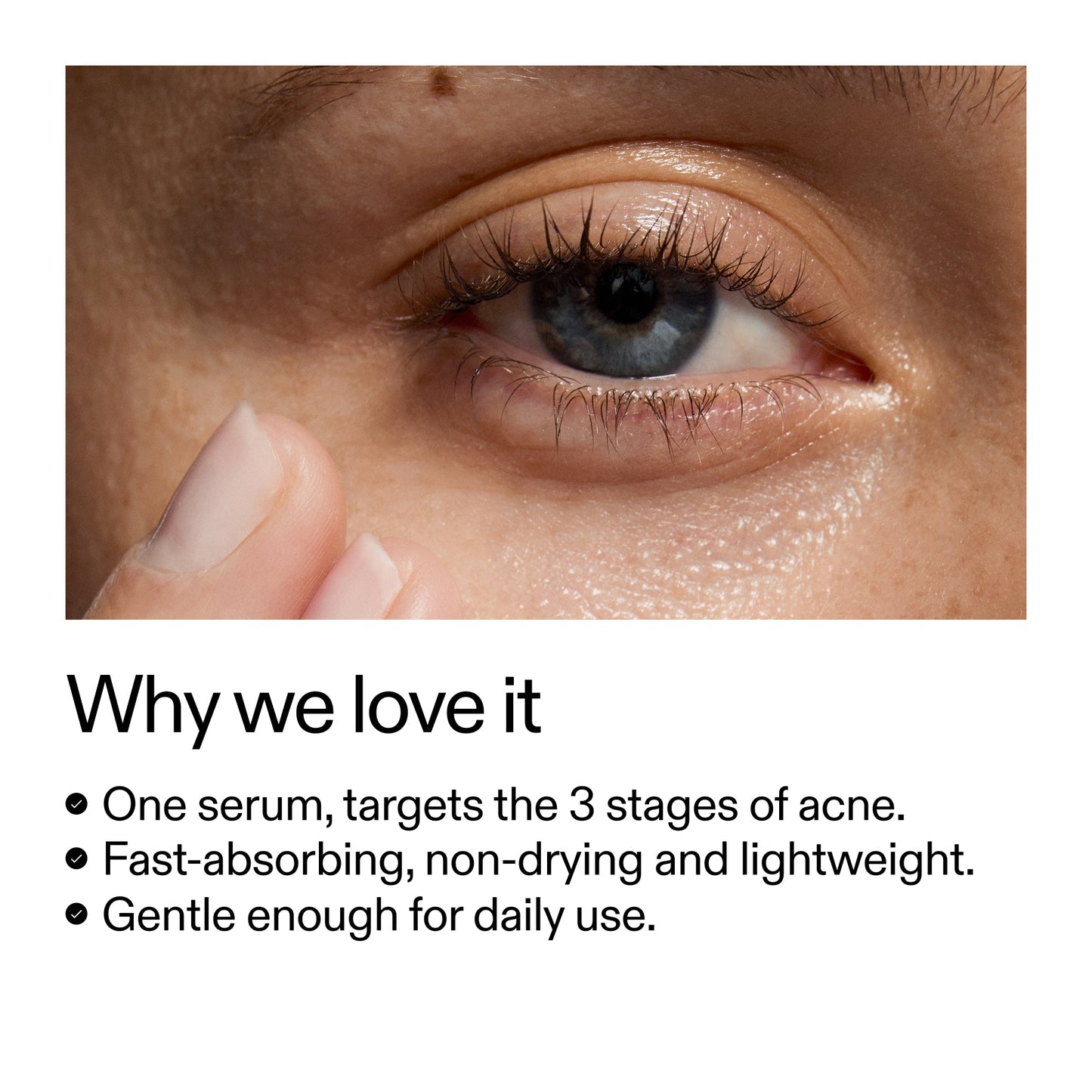 360-acne-clearing-serum-k3 Dioic_Whyweloveit_2000x2000_175aafd3-0cbe-403a-b317-a8362881bfe2.jpg