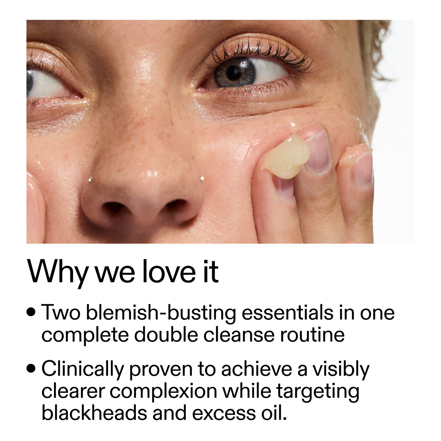 acne-double-cleanse-duo-h0 Double_Cleanse_Duo_for_Breakouts_Why_We_2000x2000_f242cb12-bb5c-487c-b203-071ccb406ec5.png
