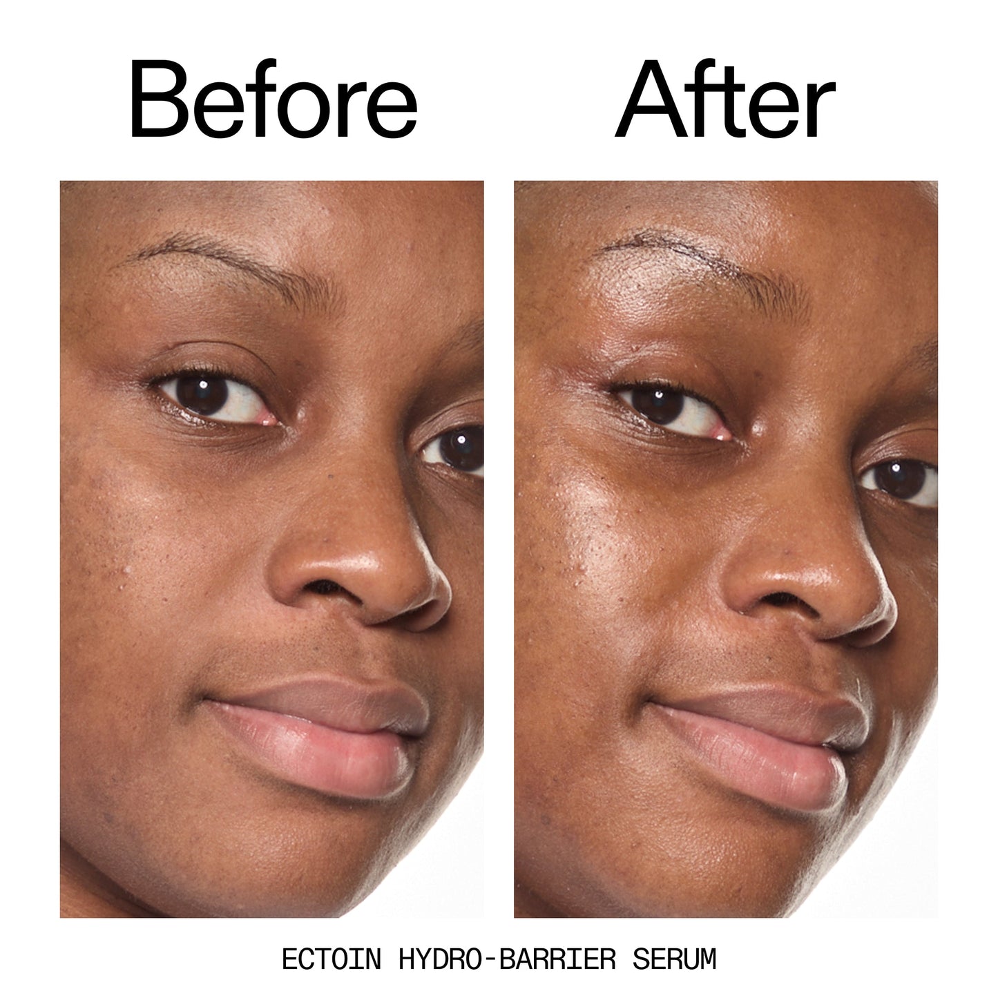 barrier-boosting-trio-d9 Ectoin_Before_After_2000x2000_ce35bc41-4da0-4b6f-adc7-29f8641f6c6c.jpg