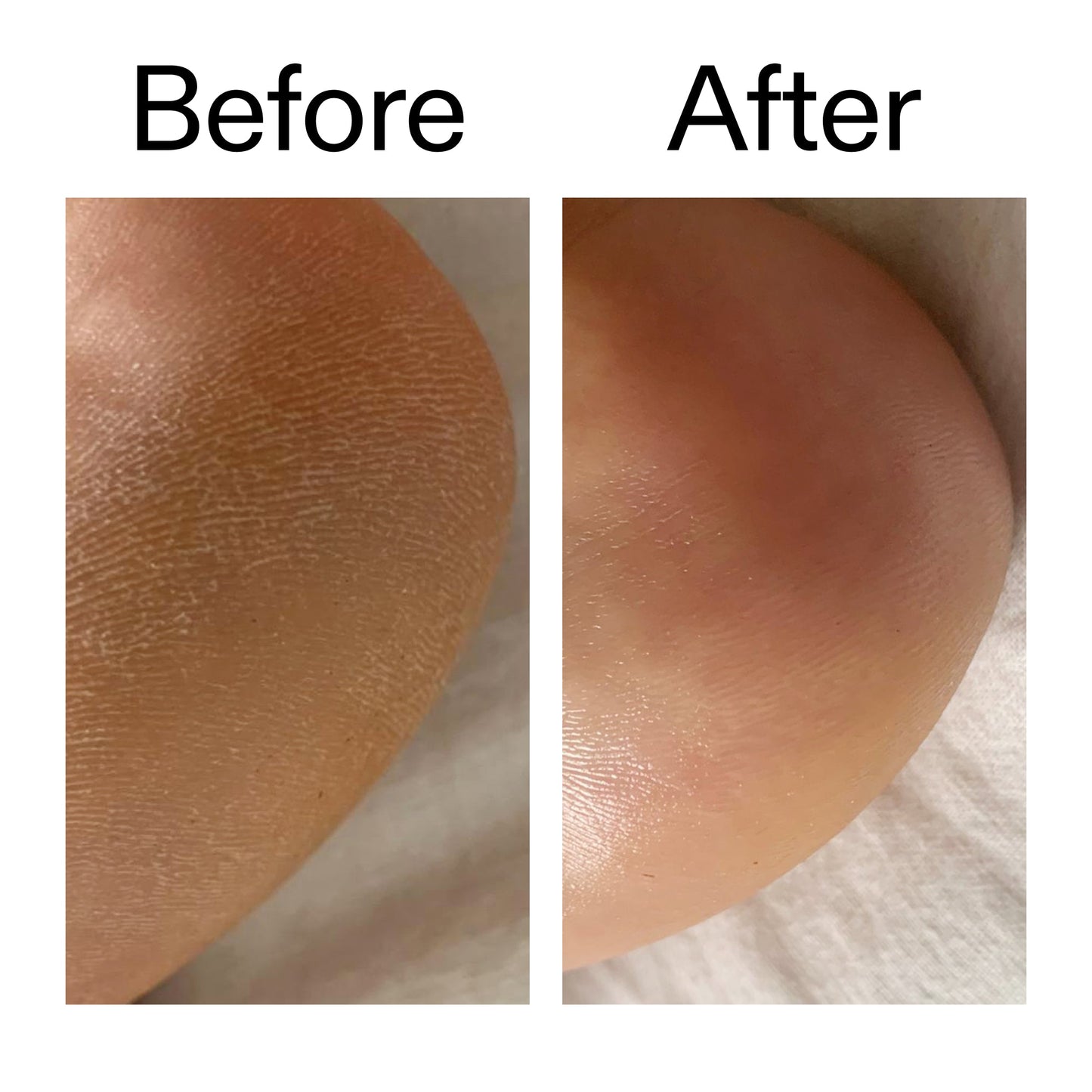 glycolic-acid-exfoliating-body-stick-duo-c5 Glycolic_Acid_Exfoliating_Body_Stick_Before_After_V1_2000x2000_a3043625-9400-429a-a7fb-d6dbd220f722.jpg