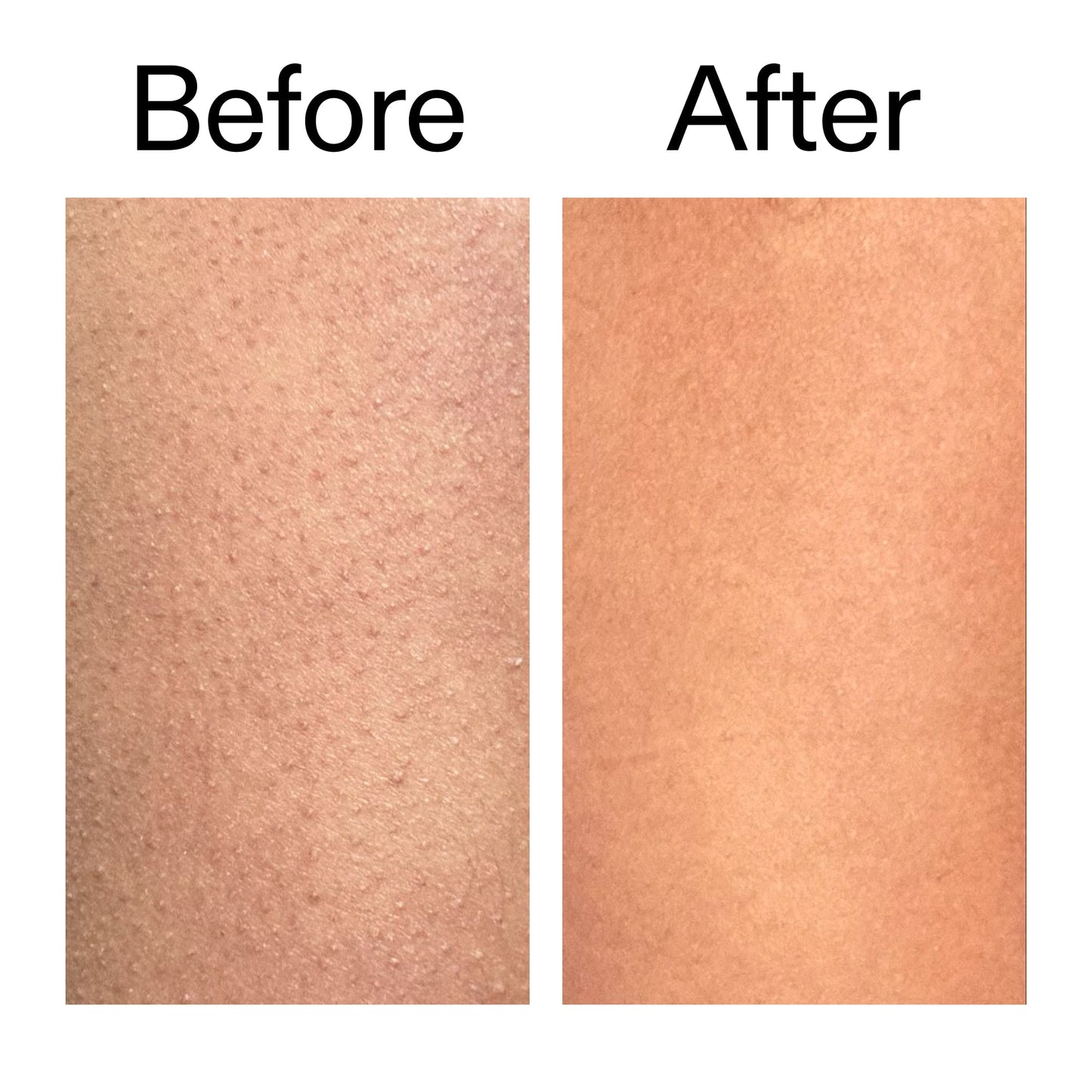 glycolic-acid-exfoliating-body-stick-j8 Glycolic_Body_Stick_B_A_2000x2000_6e6e6b4d-5bd7-43c0-aeed-4d66788e8995.jpg