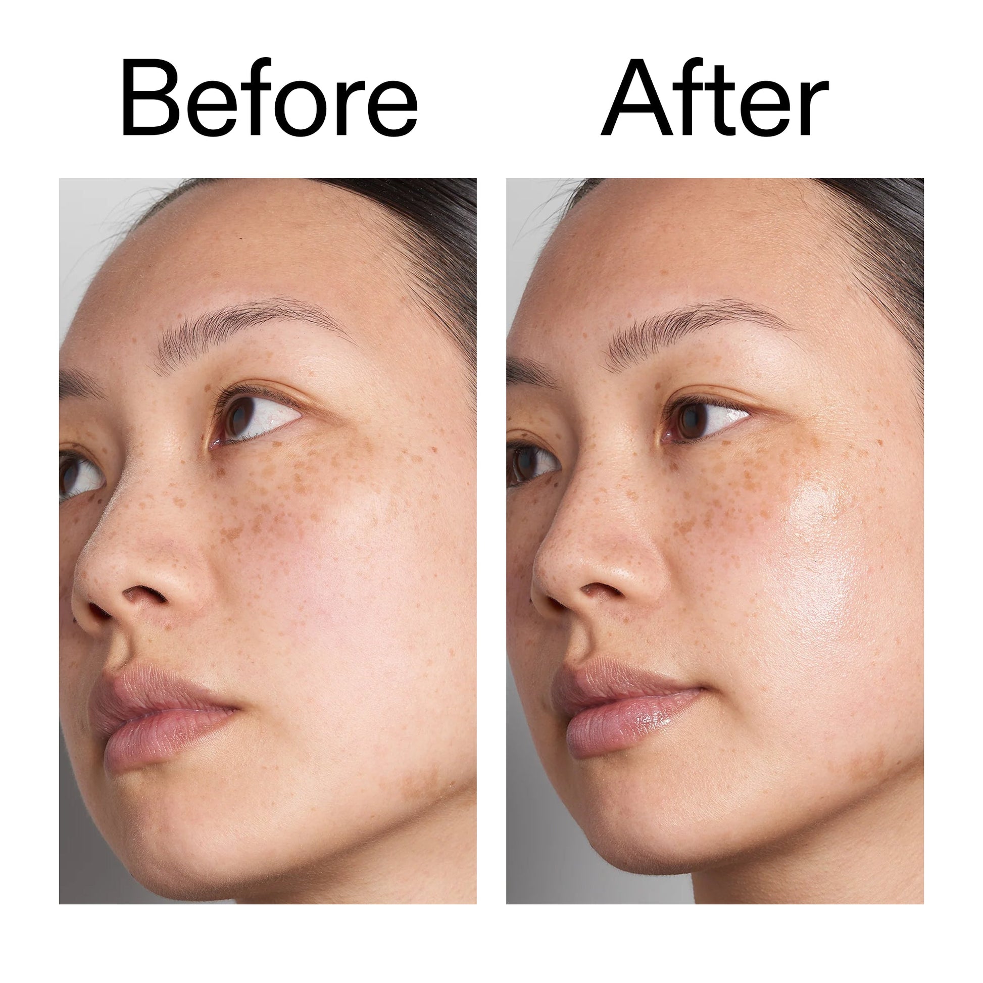 hyaluronic-acid-serum-60ml-duo-k3 Hyaluronic_Acid_Before_After_2000x2000_d566f5ba-a77e-4585-99fd-0f4682b164dd.jpg