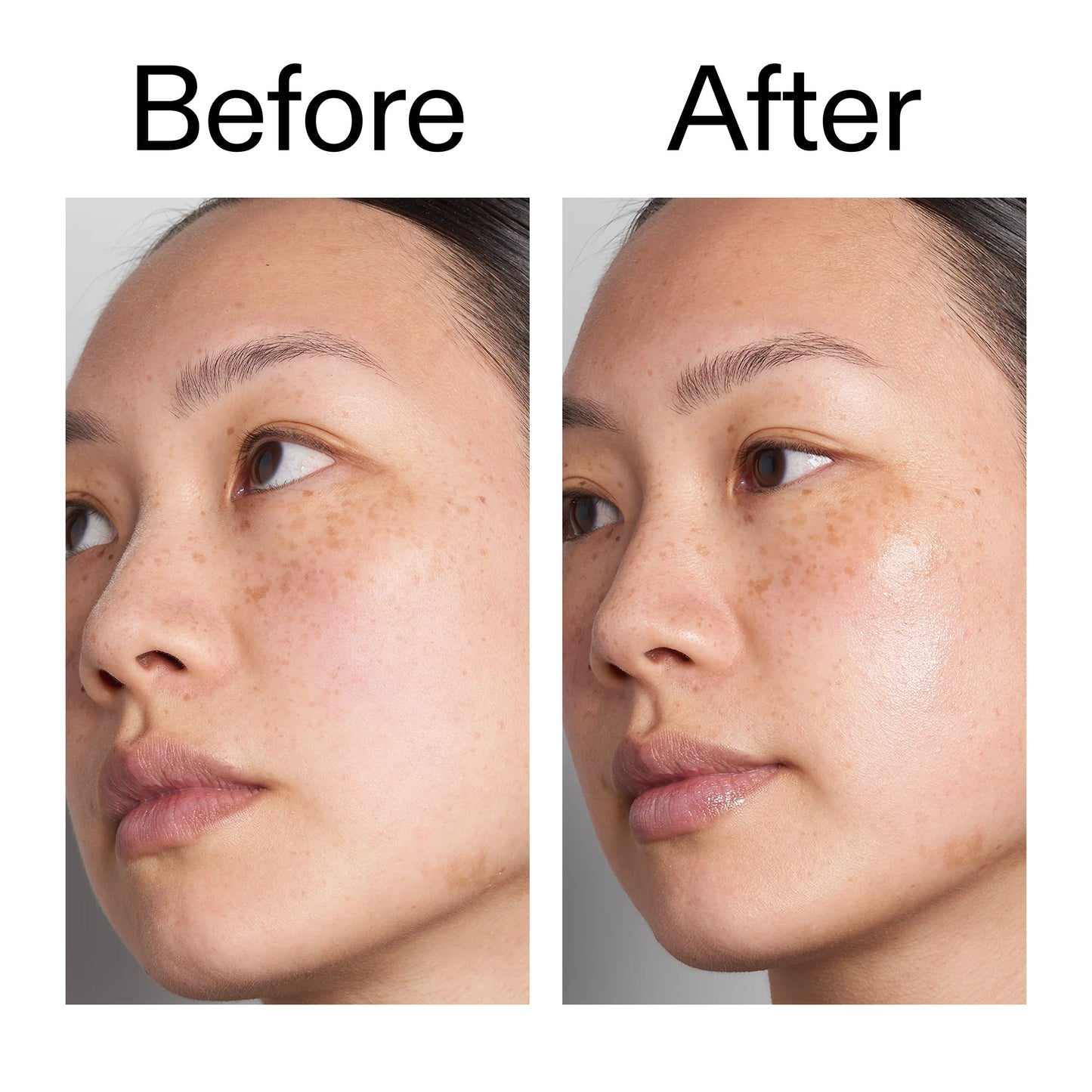 hyaluronic-acid-serum-60ml-z0 Hyaluronic_Acid_Before_After_2000x2000_d7983956-8aa2-4ea3-8255-c63e8d4f892e.jpg