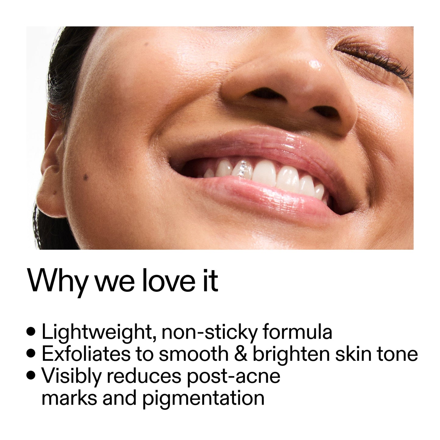 mandelic-acid-treatment-q5 Mandelic_Acid_Treatment_Why_we_love_it_2000x2000_6dfe29a9-2a79-464f-a5e8-e5ac37d93388.jpg