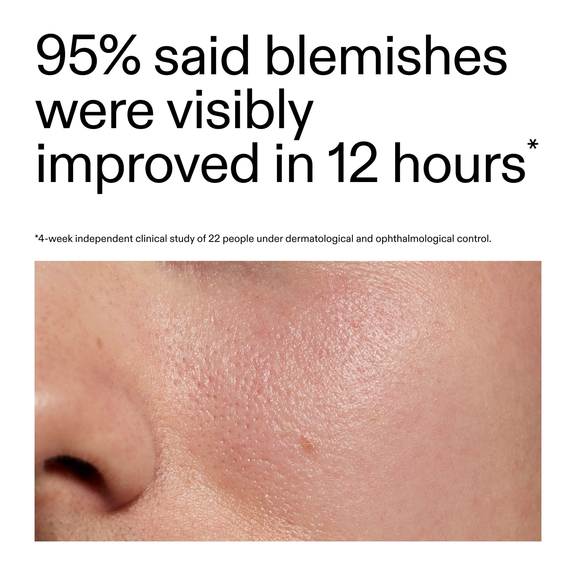 succinic-acid-acne-treatment-n6 Oat_Cleansing_Balm_Claim_2000x2000_ac6ce553-25db-41b2-a981-faae1ac4b8c0.jpg