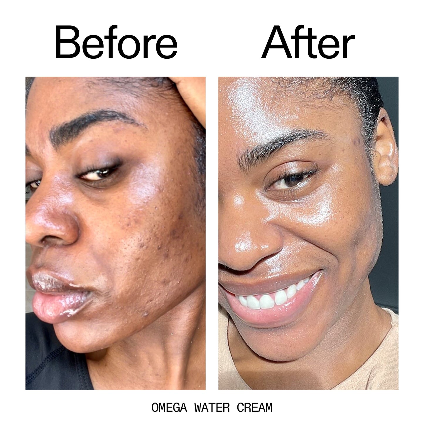 glowing-skin-set-o5 Omega_Water_Cream_Before_After_2000x2000_8e88278b-8c8d-48dc-ac77-4e98ebbd1b77.jpg