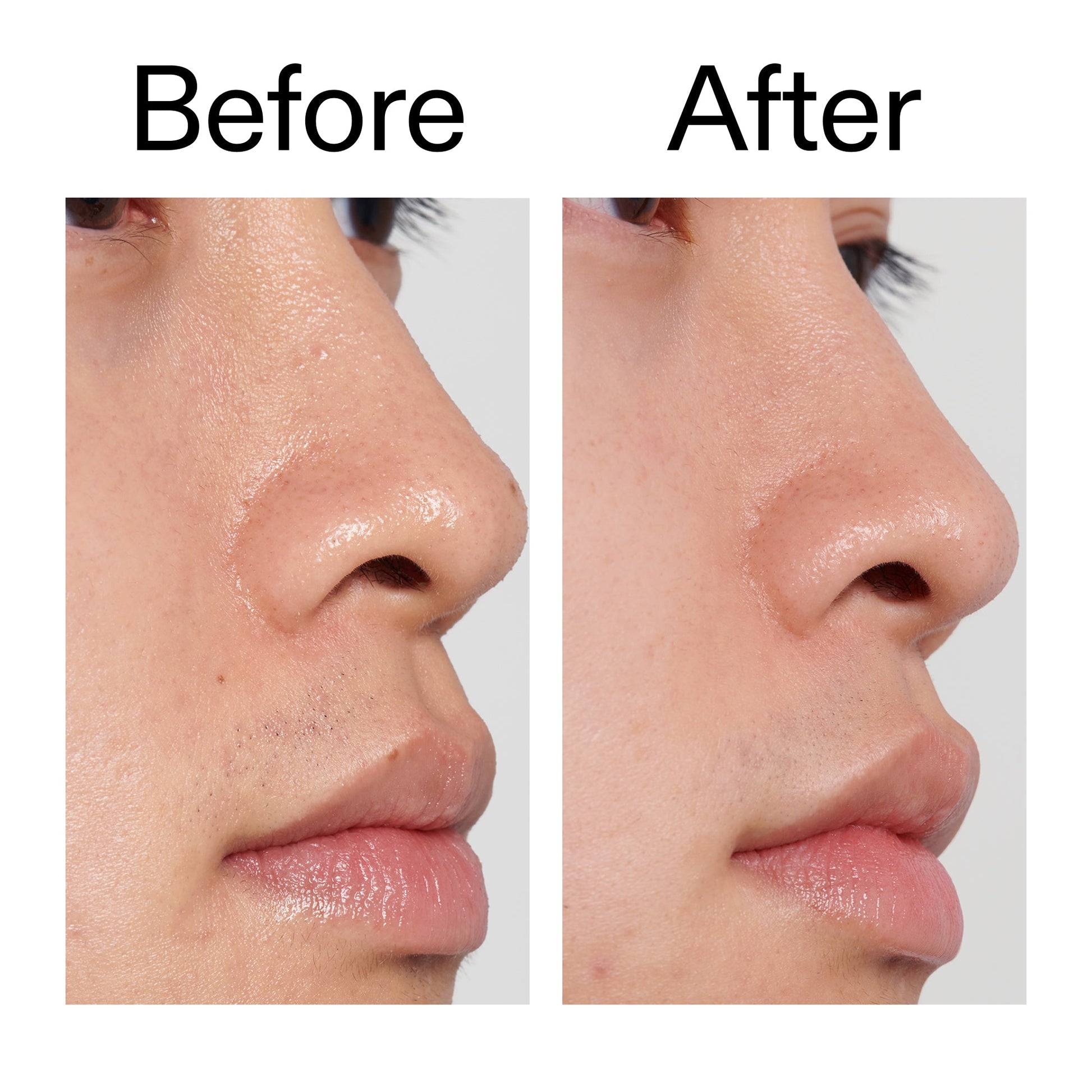 pha-toner-y1 PHA_Toner_Before_After_2000x2000_e3c10172-0150-4342-8b95-57417eaff50d.jpg
