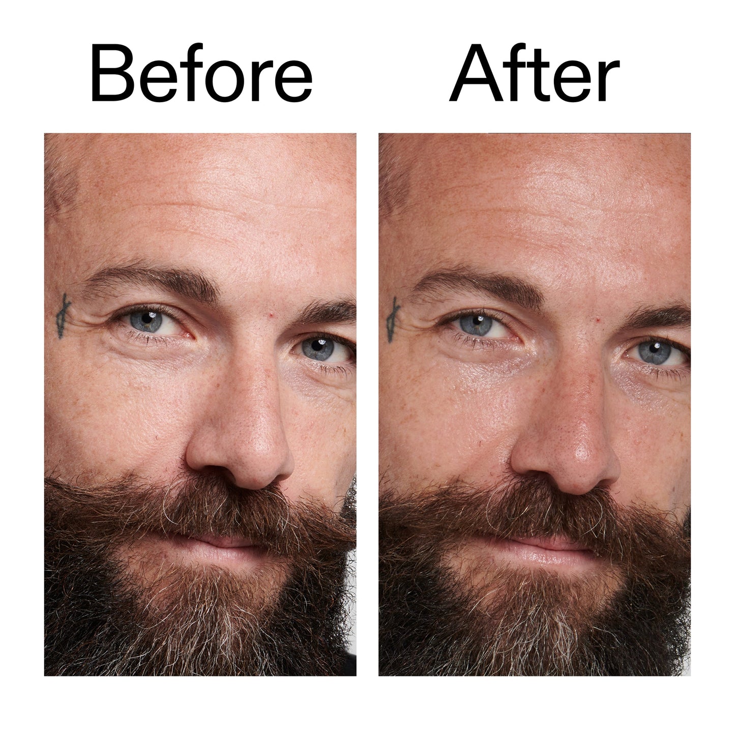 peptide-moisturizer-m8 Peptide_Moisturizer_Before_After_2000x2000_84623fe4-7b72-4f89-8e87-5edb6c752ac5.jpg
