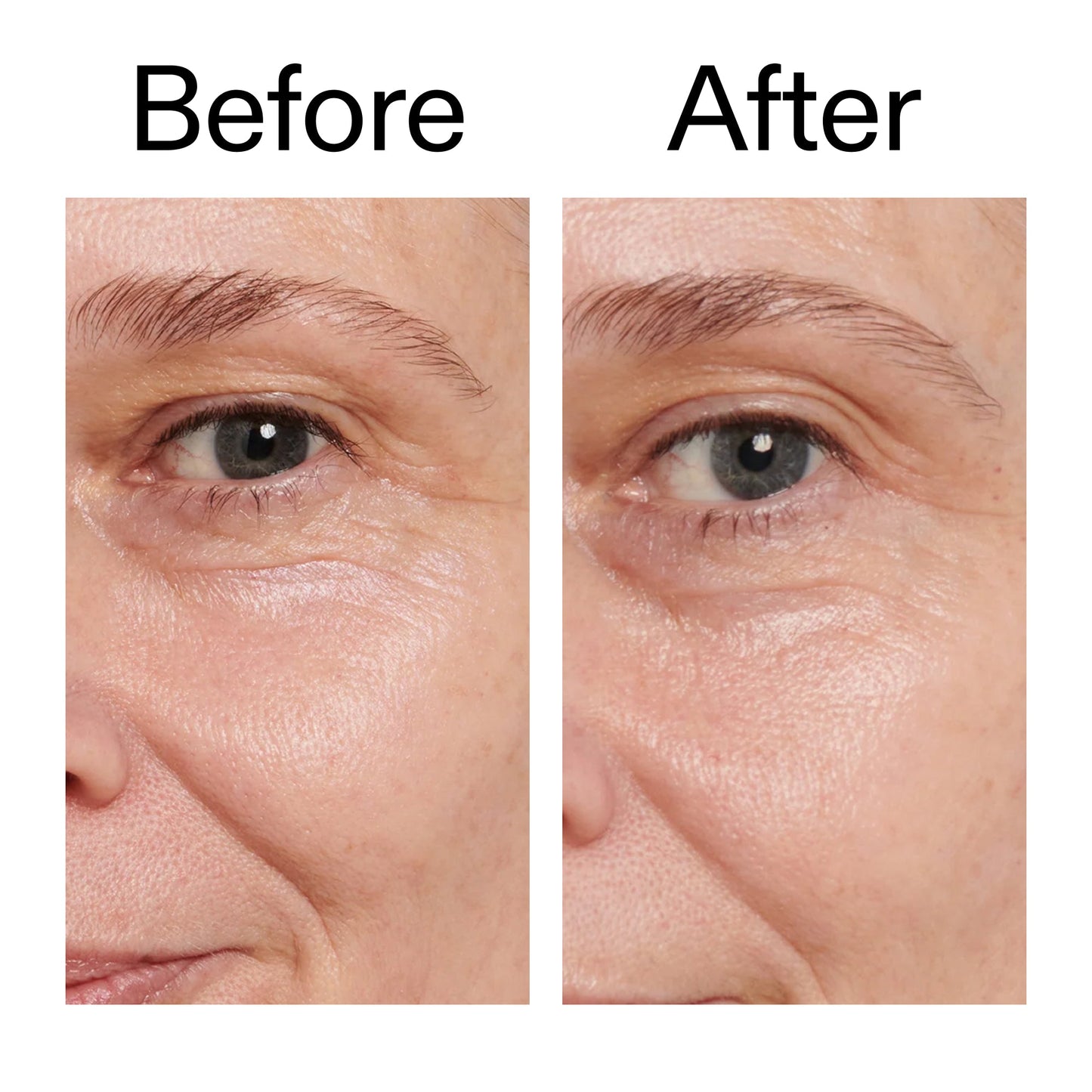 retinol-eye-cream-m8 Retinol_Eye_Cream_Before_After_2000x2000_ac03a80c-109e-4572-a95a-91dc109b4d27.jpg