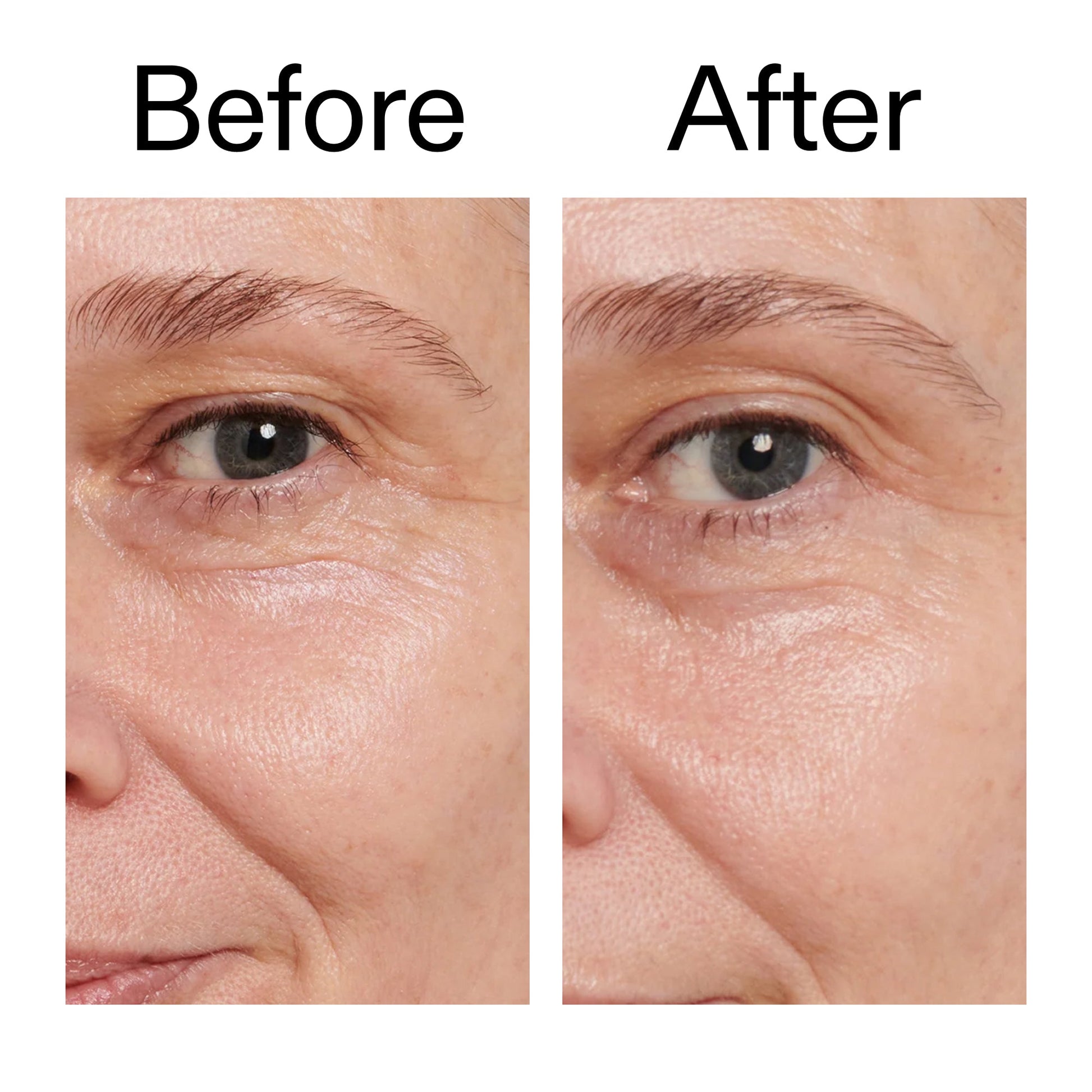 retinol-eye-cream-m8 Retinol_Eye_Cream_Before_After_2000x2000_ac03a80c-109e-4572-a95a-91dc109b4d27.jpg