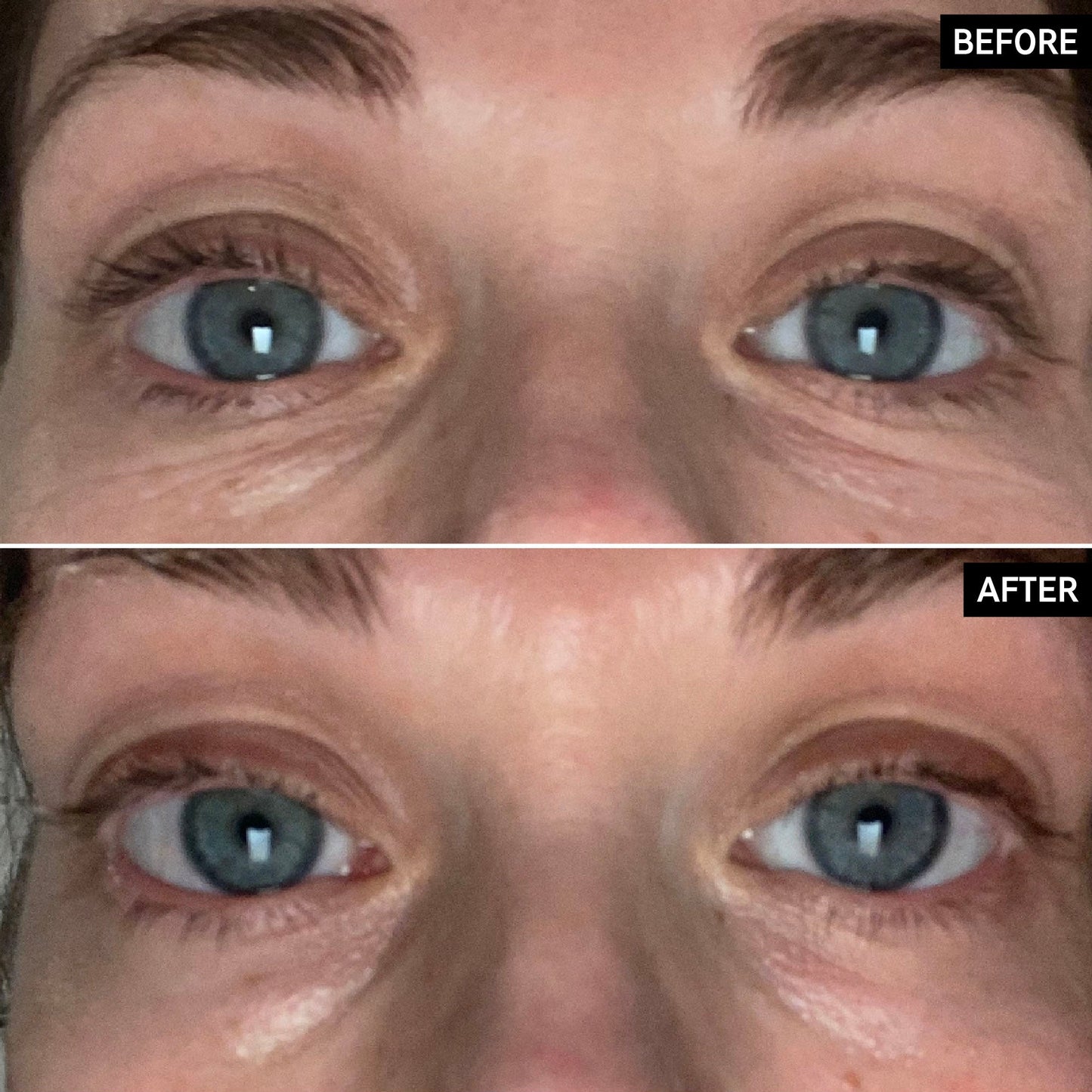 retinol-eye-cream-m8 SITE-UGCBAsApril_Nicole_B_A_PPage_2000x2000_1.jpg