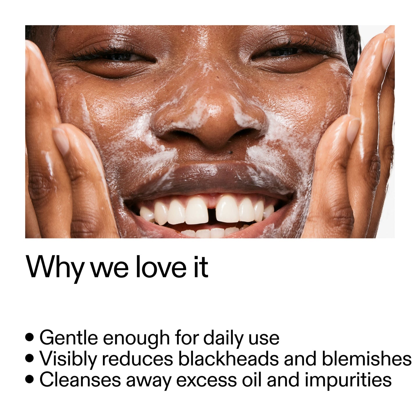 salicylic-acid-cleanser-150ml-y4 Salicylic_Acid_Cleanser_-_300mlWhy_we_love_it_2000x2000_87dc92a9-2559-4309-98cd-4e570f1be735.jpg