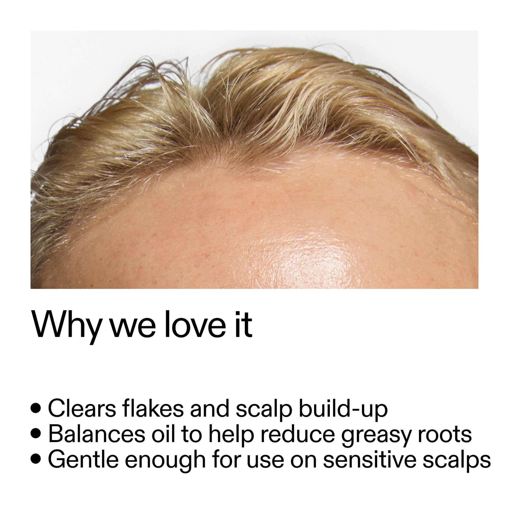 salicylic-acid-exfoliating-scalp-treatment-b8 Salicylic_Acid_Exfoliating_Scalp_Treatment_Why_we_love_it_2000x2000_44b6bd6d-9ec4-4b23-9dc4-bc3fd6f28e14.jpg