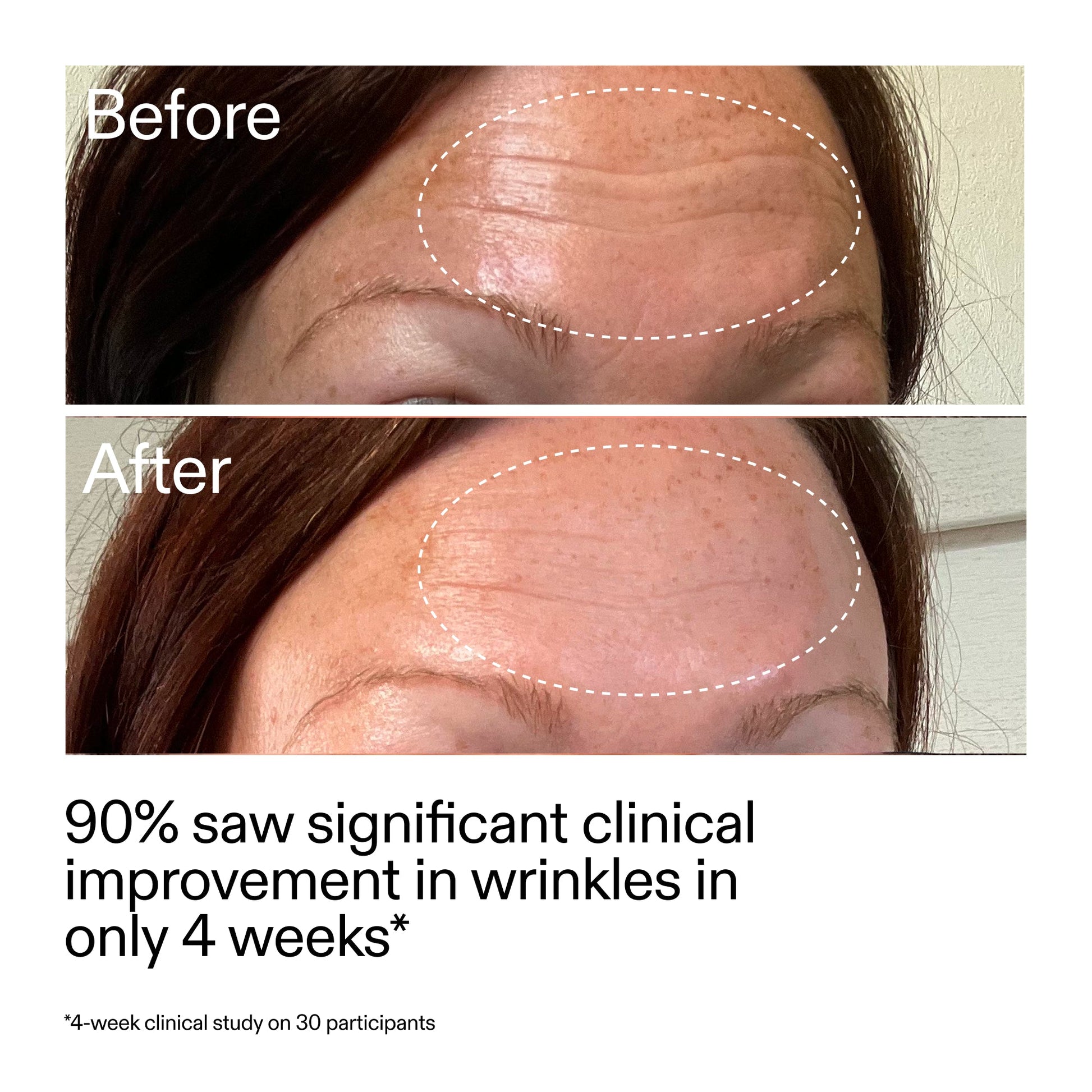 starter-retinol-serum-d2 StarterRetinol_BeforeAfter_Claim1_2000x2000_a09b50b6-4688-4527-abae-21bd142b89b7.jpg