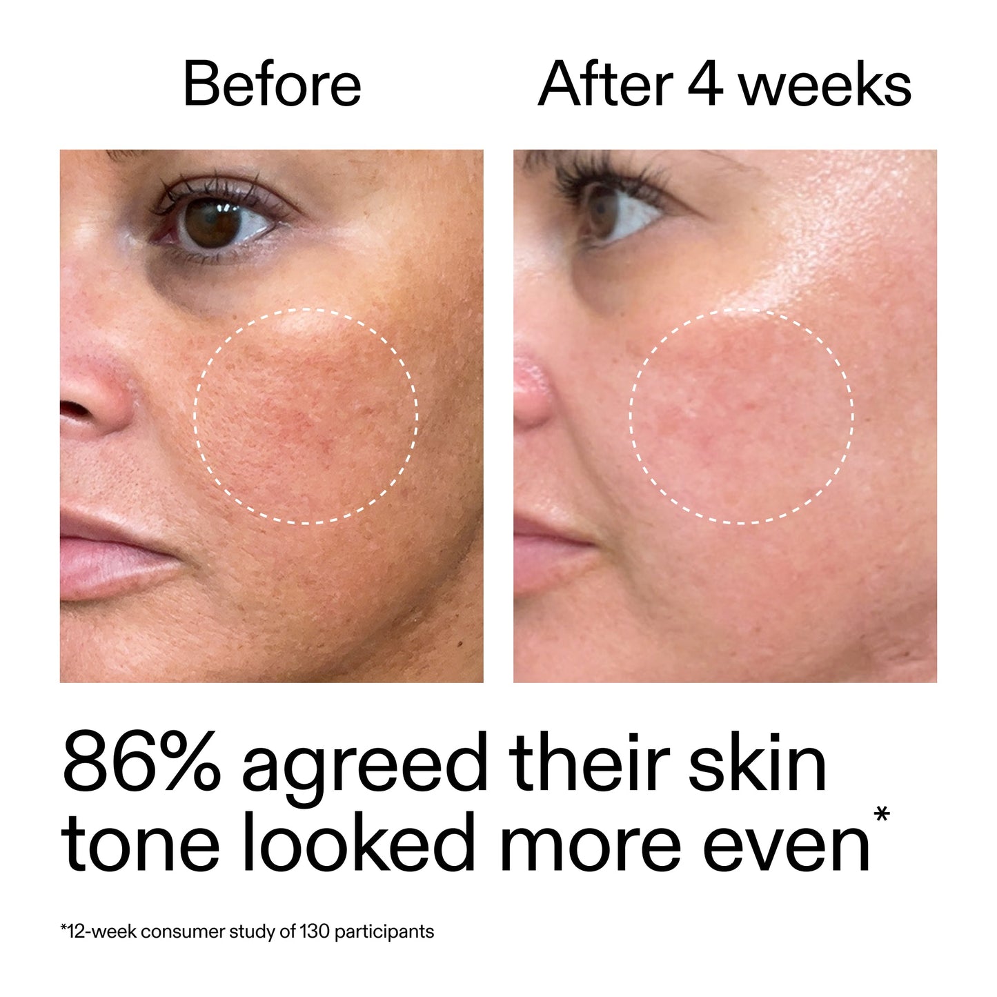 starter-retinol-serum-duo-m2 StarterRetinol_BeforeAfter_Claim2_2000x2000_fc5bb8ac-8588-478f-98d5-28af6651601a.jpg