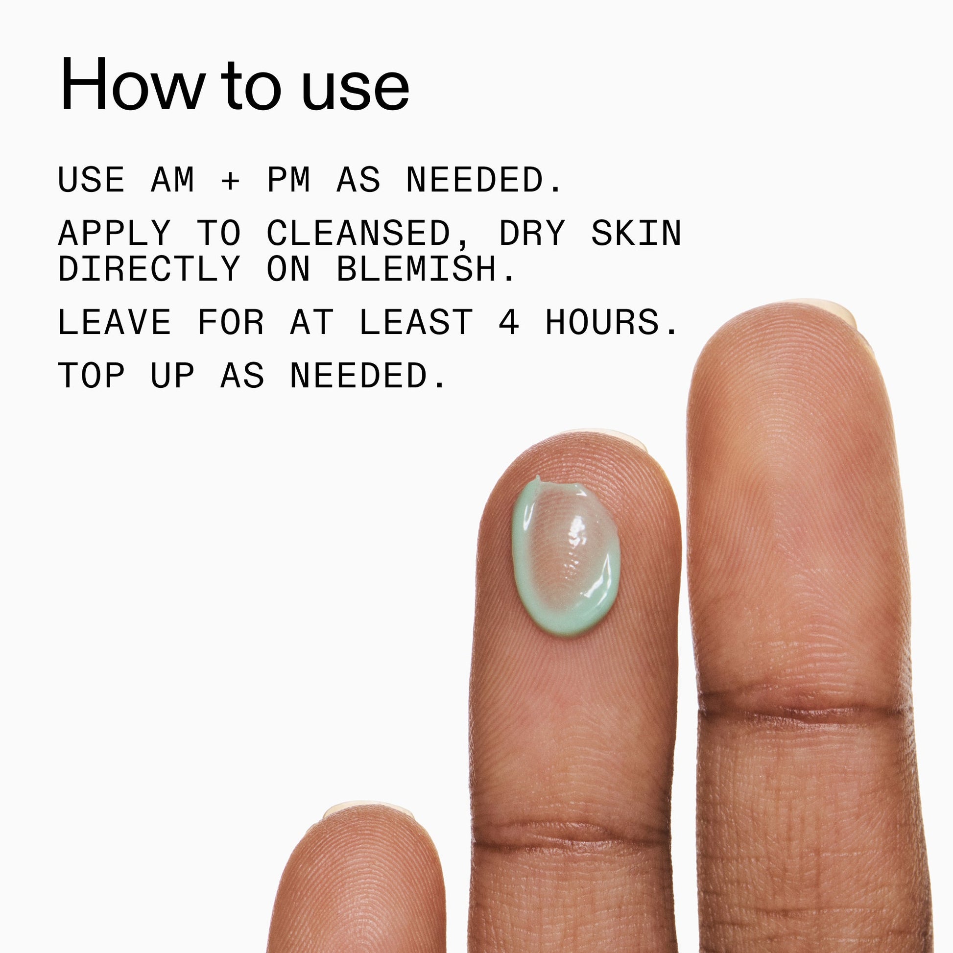 succinic-acid-acne-treatment-n6 Succinic_Acid_Treatment_How_to_Use_2000x2000_d57137d5-d7f1-427c-9a46-5fc00c19c542.jpg
