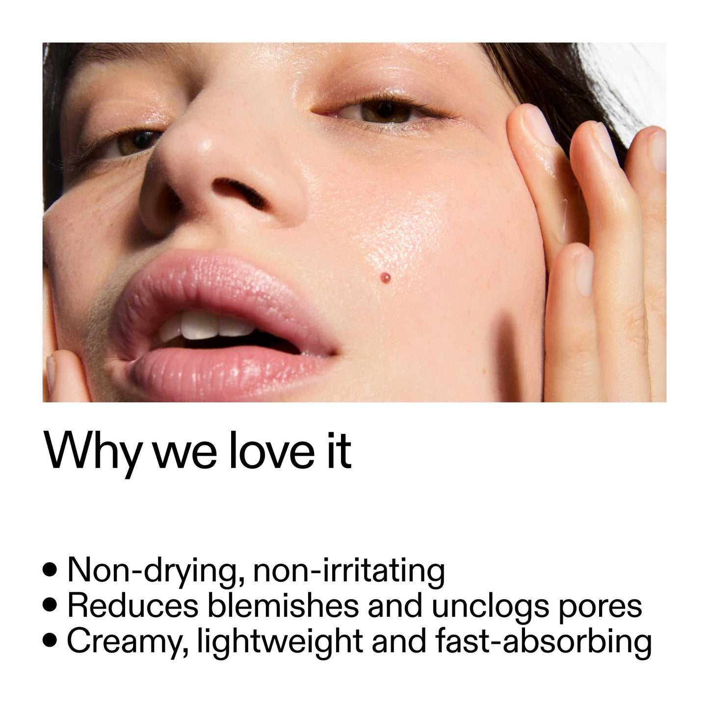 succinic-acid-acne-treatment-n6 Succinic_Acid_Treatment_Why_we_love_it_2000x2000_e90dd42a-cfe9-48b5-a2c7-d5eda787a6a8.jpg