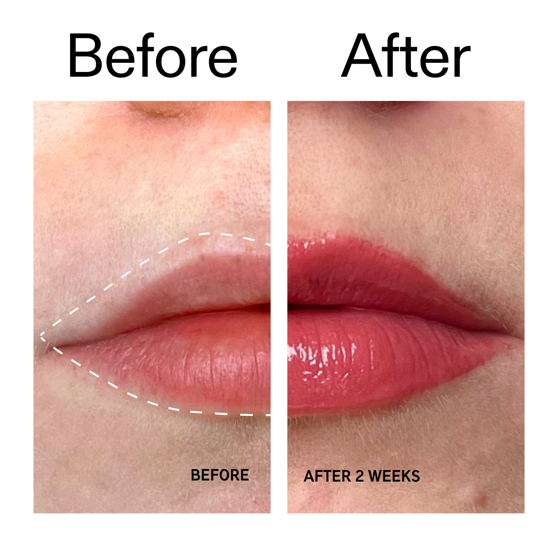 tripeptide-plumping-berry-lip-balm-g6 Tripeptide_Plumping_Lip_Balm_-_Berry_Before_After_2000x2000_9474bbd8-43ca-4b0e-b0e7-dfab70b91927.jpg