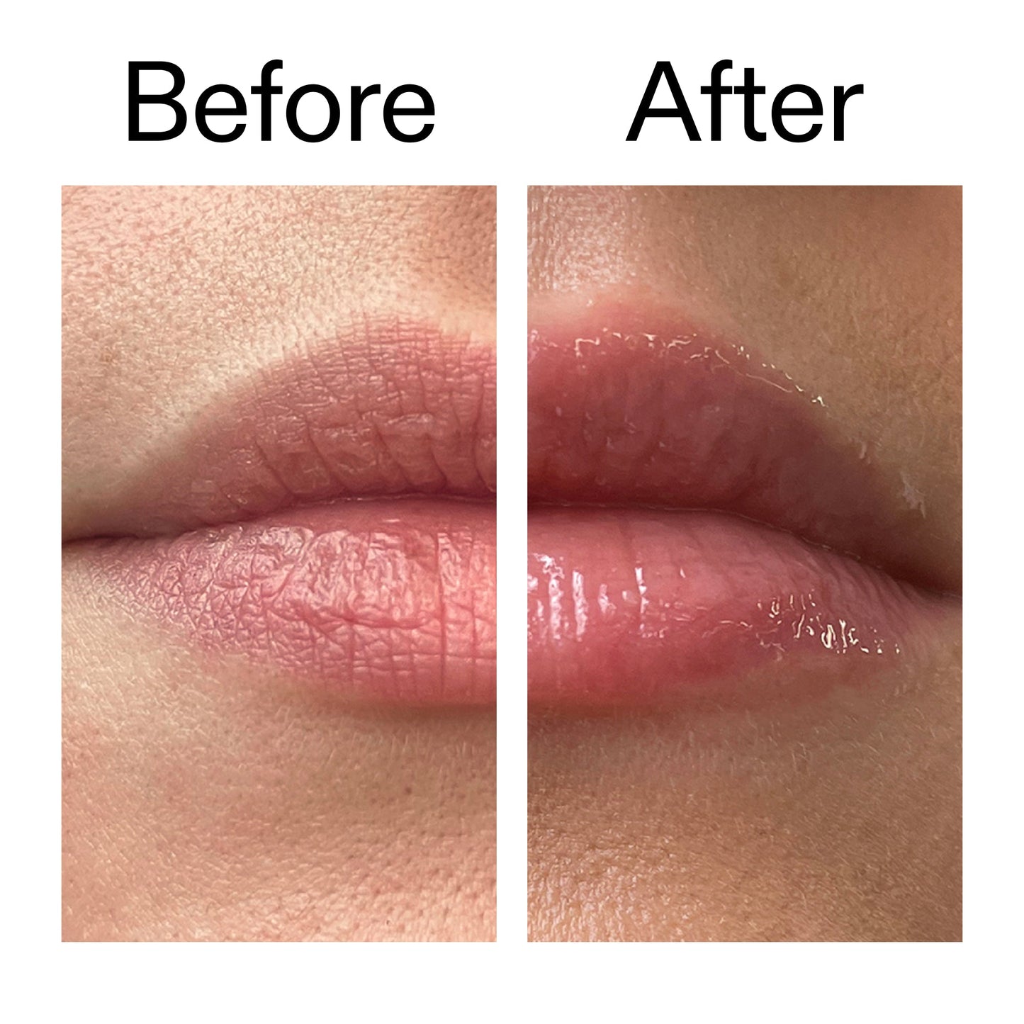 tripeptide-plumping-lip-balm-a3 Tripeptide_Plumping_Lip_Balm_Before_After_2000x2000_b4a5ee04-d2ac-4857-8f01-17209acc4bf3.jpg
