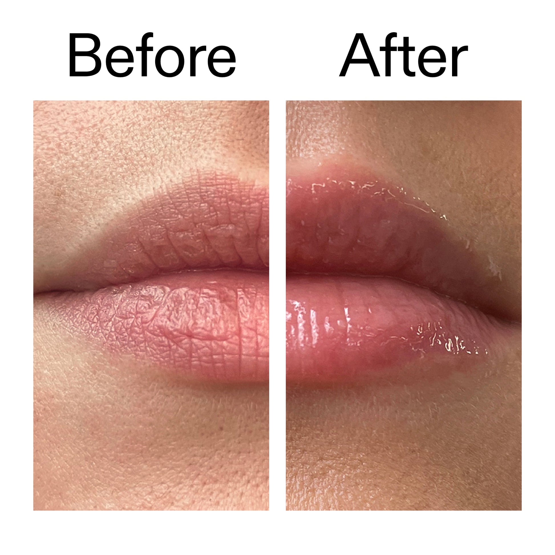 tripeptide-plumping-lip-balm-a3 Tripeptide_Plumping_Lip_Balm_Before_After_2000x2000_b4a5ee04-d2ac-4857-8f01-17209acc4bf3.jpg