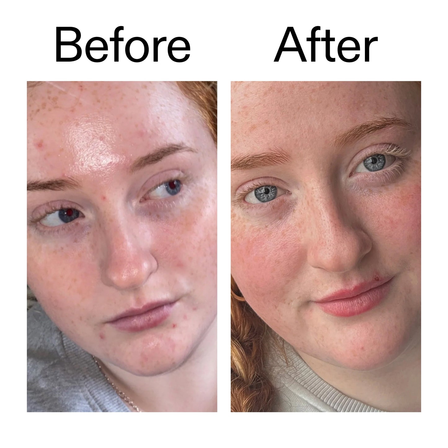 vitamin-b-c-and-e-moisturizer-x0 Vitamin_B_C_and_E_Moisturizer_Before_After_2000x2000_b0781a76-5ad2-4be9-95b8-ef92b356833c.jpg